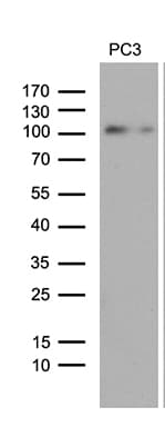 NIRF / UHRF2 Antibody (aa1-288, clone OTI1H2)