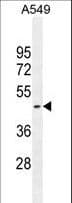 Polyclonal Rabbit anti-Human HEMK1 Antibody (aa311-338, IHC, WB)
