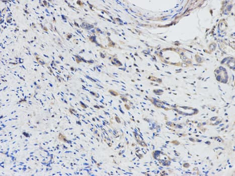DPYD / DPD Antibody