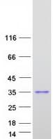 Human KCNIP2 / KCHIP2 Protein (Recombinant Myc-DDK (Flag))