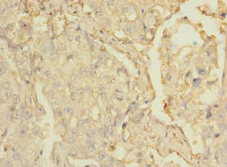 MARCO Antibody
