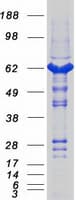 Human CASQ1 / Calsequestrin 1 Protein (Recombinant Myc-DDK (Flag))