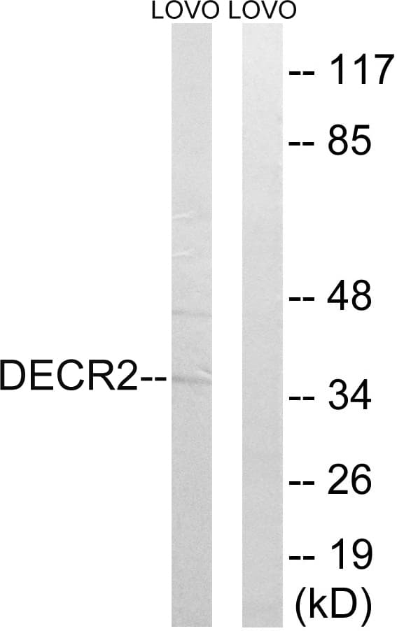 Polyclonal Rabbit anti-Human DECR2 Antibody (aa217-266, WB)