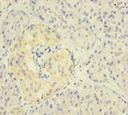 ZNF114 Antibody