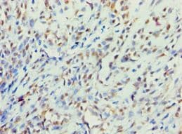 IHC-plus™ BBS4 Antibody (aa350-519)