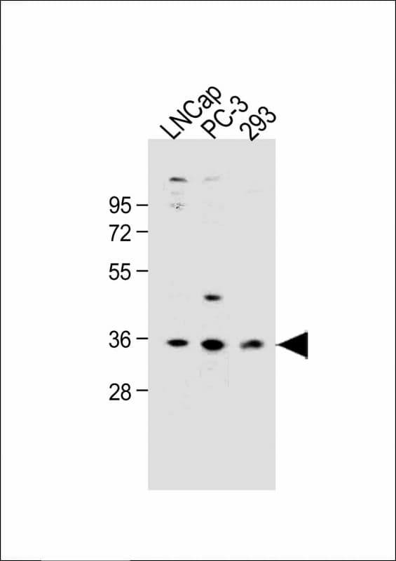 OR6C3 Antibody (Internal)