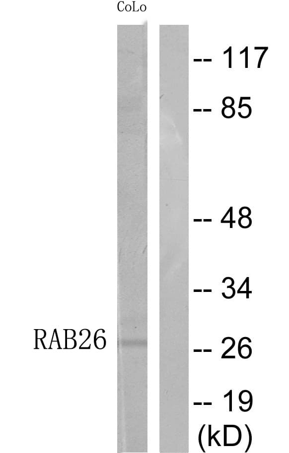 Polyclonal Rabbit anti-Human RAB26 Antibody (WB)