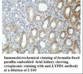 LYPD1 Antibody (aa22-71)