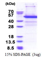 Human PSMD11 Protein (Recombinant His)