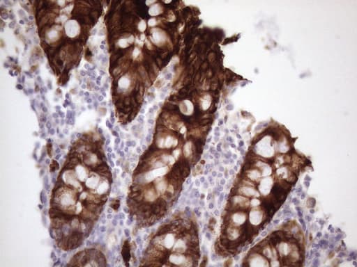 KRT16 / CK16 / Cytokeratin 16 Antibody (clone OTI1G5)
