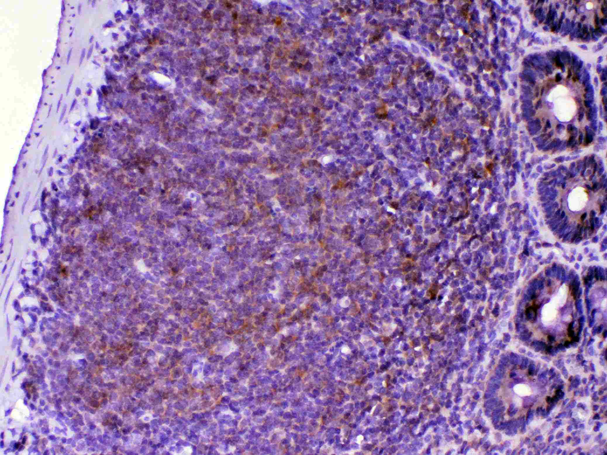 CTLA4 / CD152 Antibody (aa36-161)