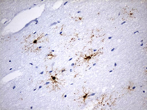 GPR17 Antibody (C-Terminus, clone OTI17C1)