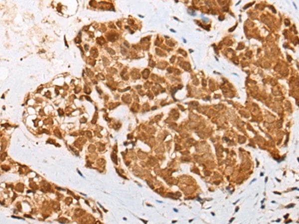 DRPLA / Atrophin-1 Antibody