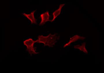 CD32C Antibody