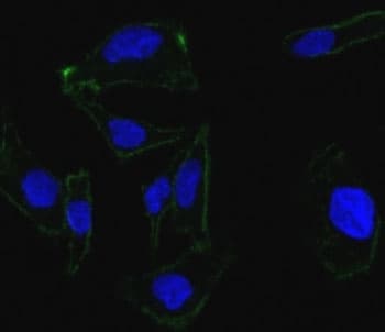 EPCAM Antibody (clone EGP40/837)