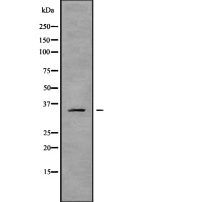 Polyclonal Rabbit anti-Human OR2B6 Antibody (IHC, WB)