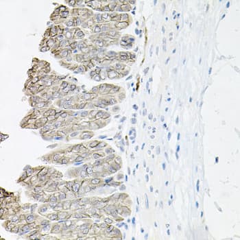 ATP1B1 Antibody