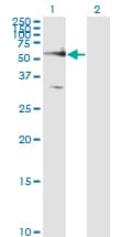 FZD5 / Frizzled 5 Antibody (clone 6A3)