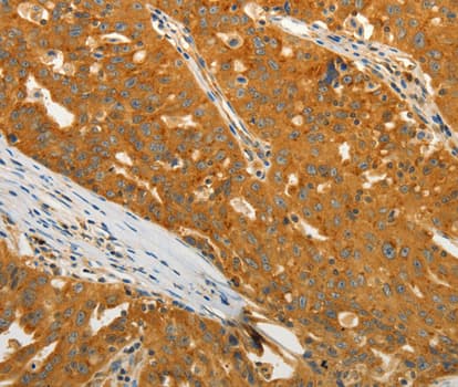 US01 / p115 Antibody
