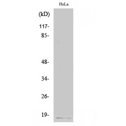 p16INK4a / CDKN2A Antibody (10-90 aa, N-terminal)