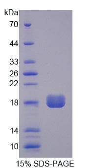 Human LPP3 / PPAP2B Protein (Recombinant His, N-Terminal)