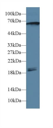 CAMK2G / CaMK II Gamma Antibody (aa6-208, Biotin)
