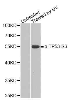 TP53 / p53 Antibody (phospho-Ser6)