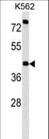 Polyclonal Rabbit anti-Human P2RX2 / P2X2 Antibody (aa81-109, WB)