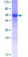 Human CCDC69 Protein (Recombinant GST)
