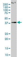 Monoclonal Mouse anti-Human PCYT1A / CCT Alpha Antibody (clone 6E6, WB)