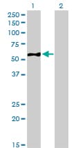 Monoclonal Mouse anti-Human EIF5 Antibody (clone 2E6-4C12, IHC, IF, WB)