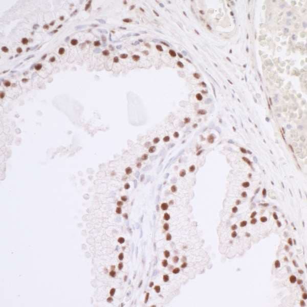 RBM39 Antibody (aa325-375)