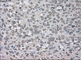 Monoclonal Mouse anti-Human NTRK3 / TRKC Antibody (clone OTI4E10, IHC, IF, WB)