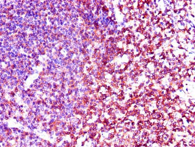 Polyclonal Rabbit anti-Human p56lck / LCK Antibody (aa1-539, WB)