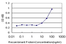 ROPN1 / Ropporin Antibody (clone 4E11)