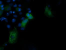 PIK3R5 Antibody (clone OTI6C5)