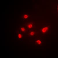 TBP / GTF2D Antibody (Internal)