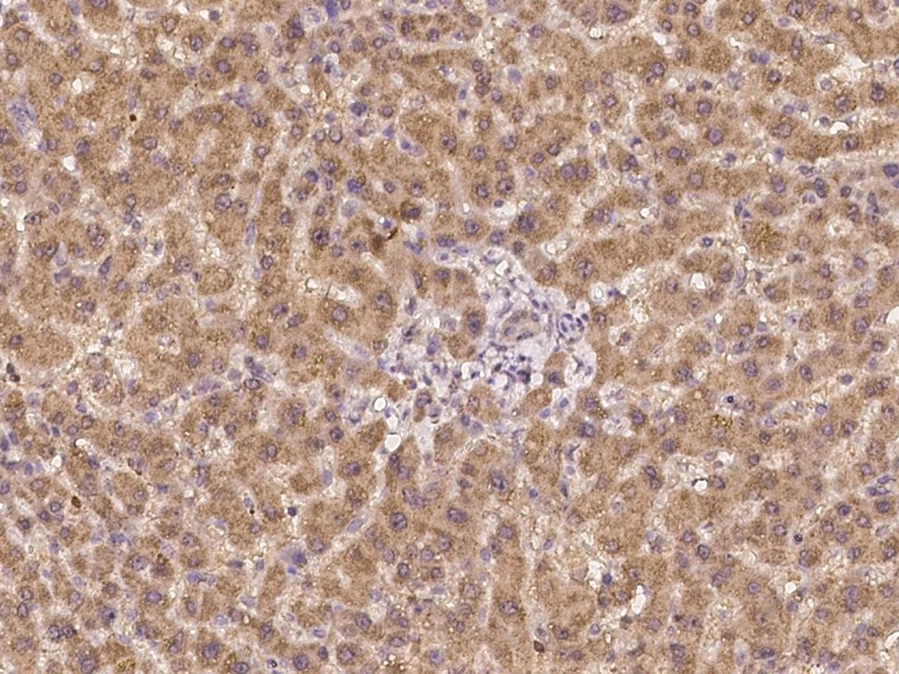 CP / Ceruloplasmin Antibody