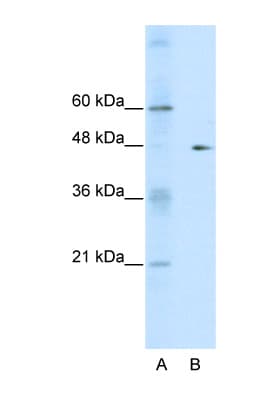 Polyclonal Rabbit anti-Human GDI2 Antibody (aa361-410, IHC, WB)