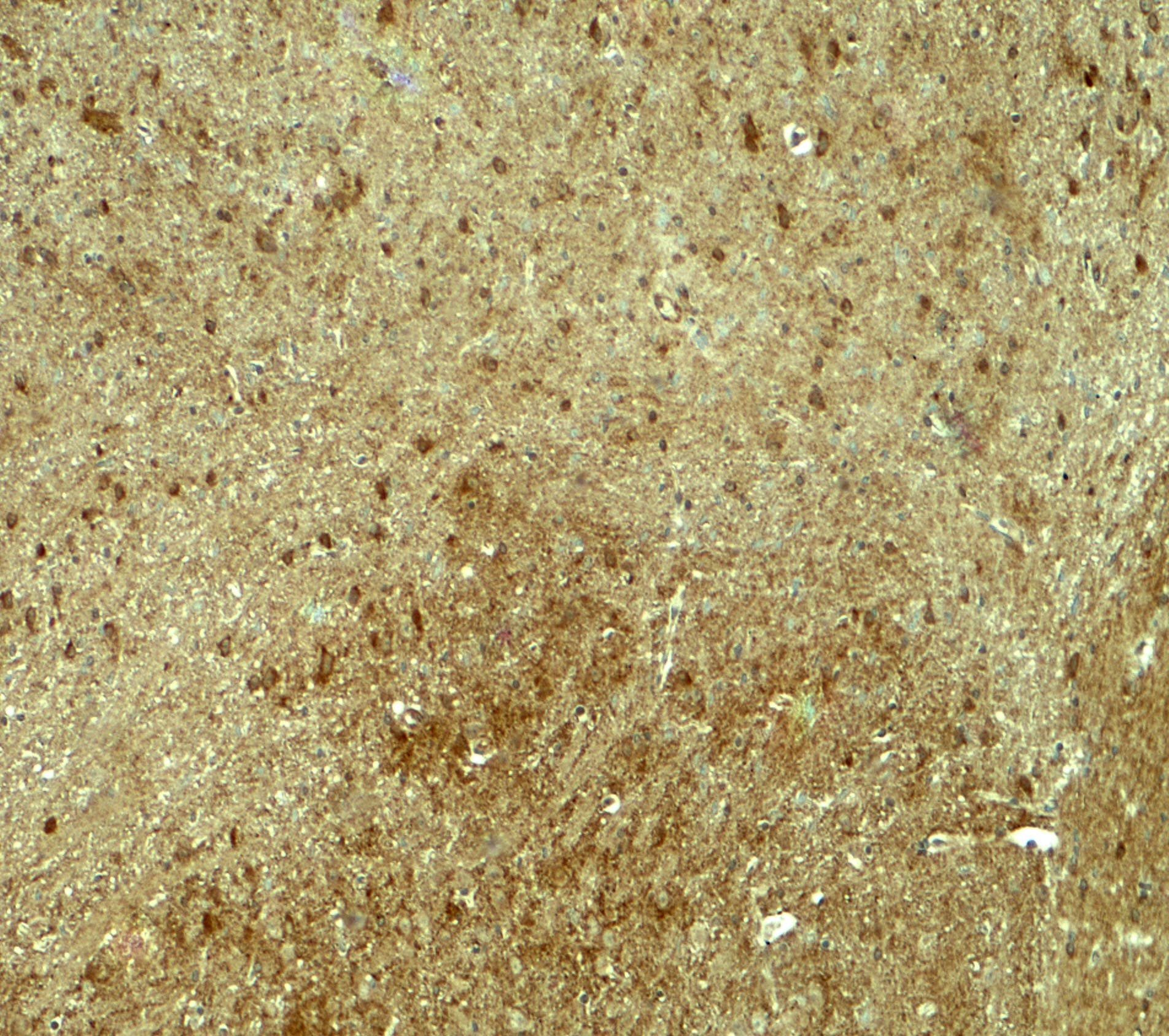 PJA1 / PRAJA1 Antibody