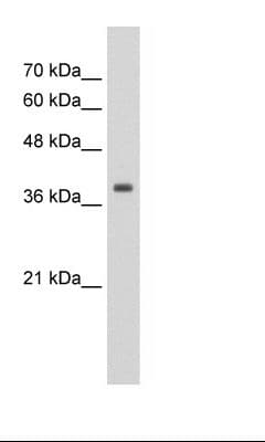 TPM1 / Tropomyosin Antibody (aa20-69)