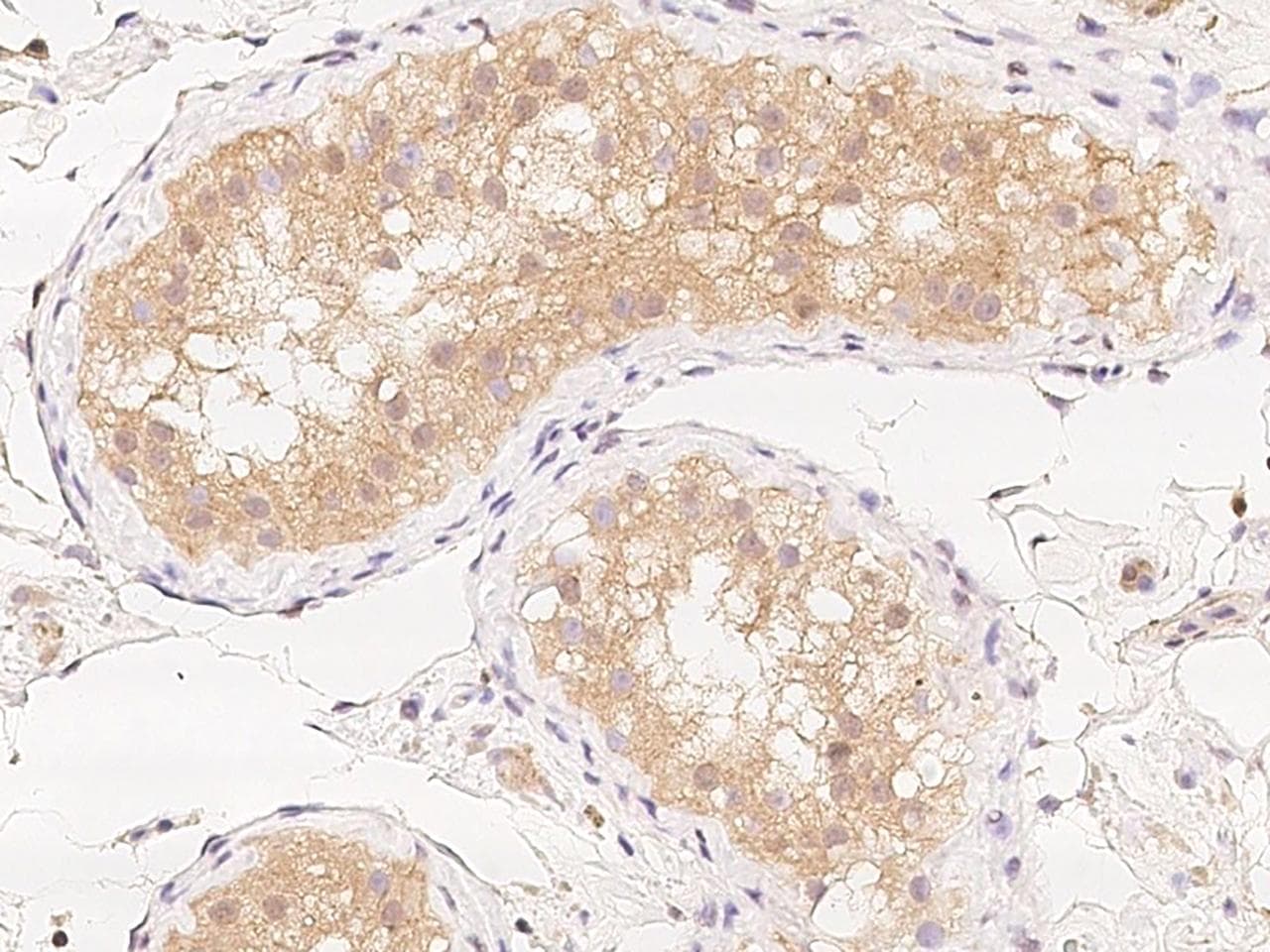ZNF804B Antibody