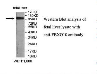 FBXO10 Antibody (aa11-179)