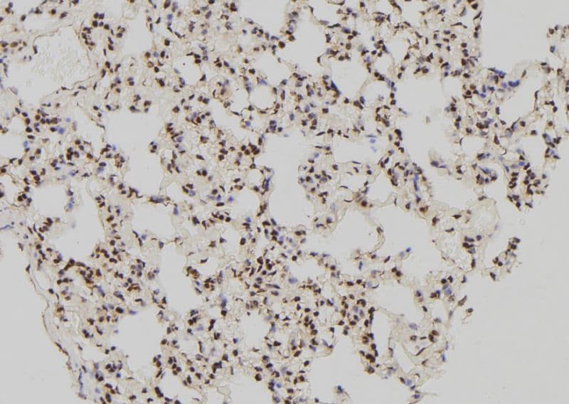 Polyclonal Rabbit anti-Human ATF4 Antibody (IHC, IF, WB)