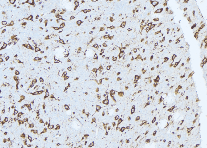 ATP6V1H Antibody