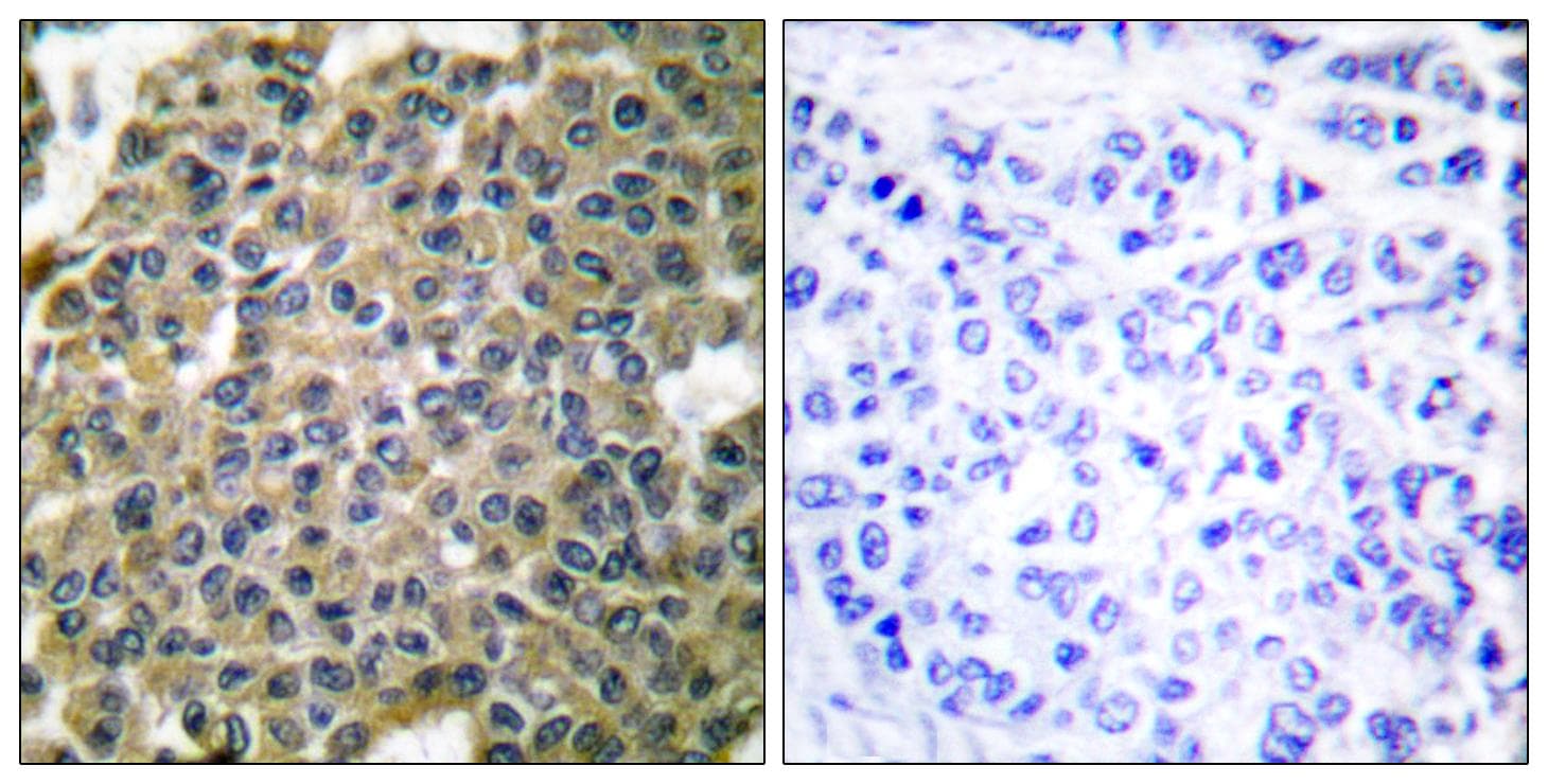 KRT7 / CK7 / Cytokeratin 7 Antibody
