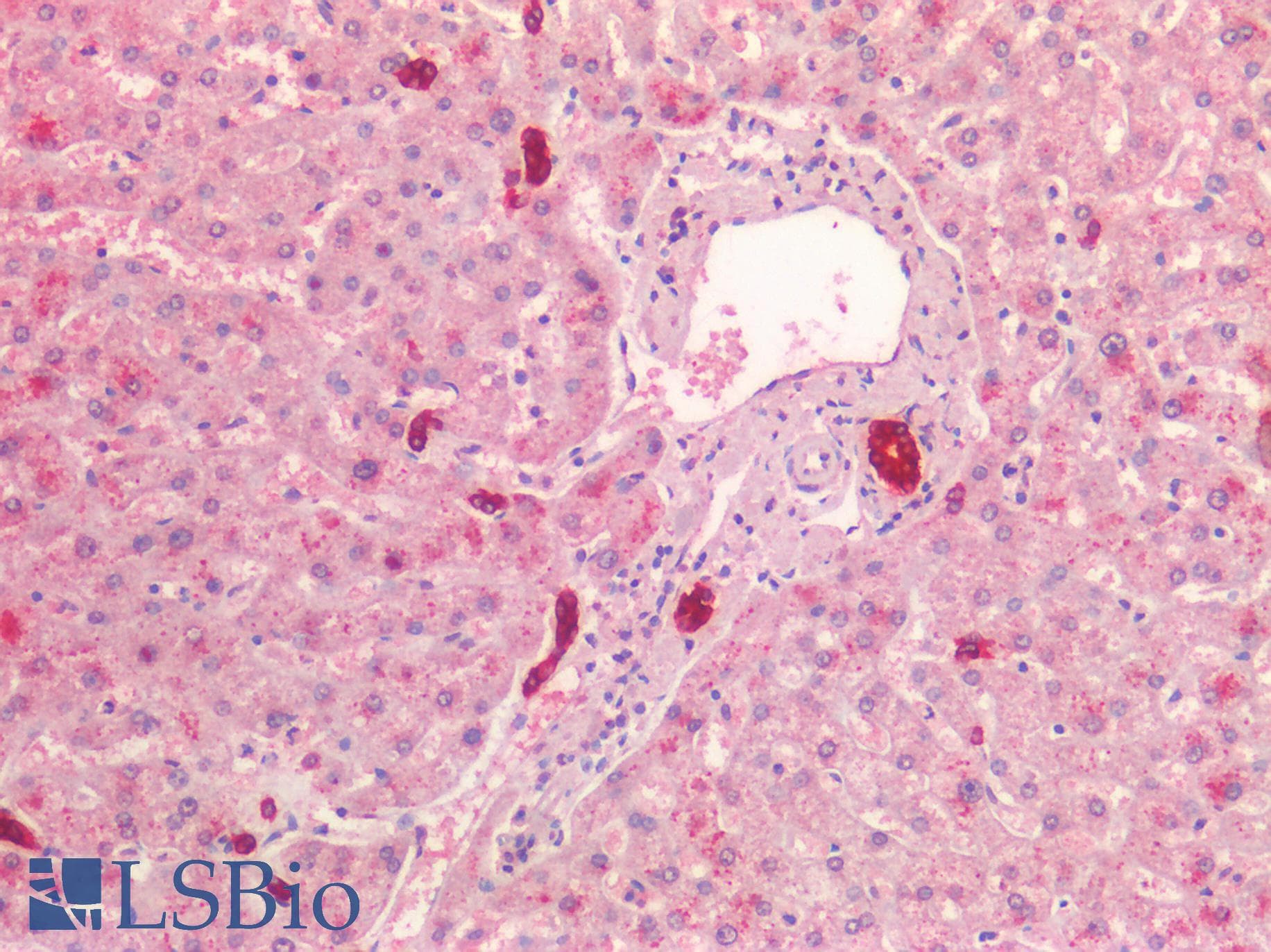 PathPlus™ Polyclonal Goat anti-Human KRT19 / CK19 / Cytokeratin 19 Antibody (aa385-398, IHC, WB)