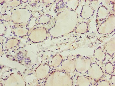 ZDHHC12 Antibody