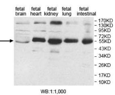 AP1M2 Antibody (aa199-373)