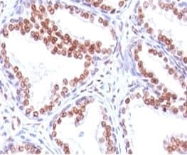 Monoclonal Mouse anti-Human AR / Androgen Receptor Antibody (clone SPM335, aa300-316, IHC, IF)